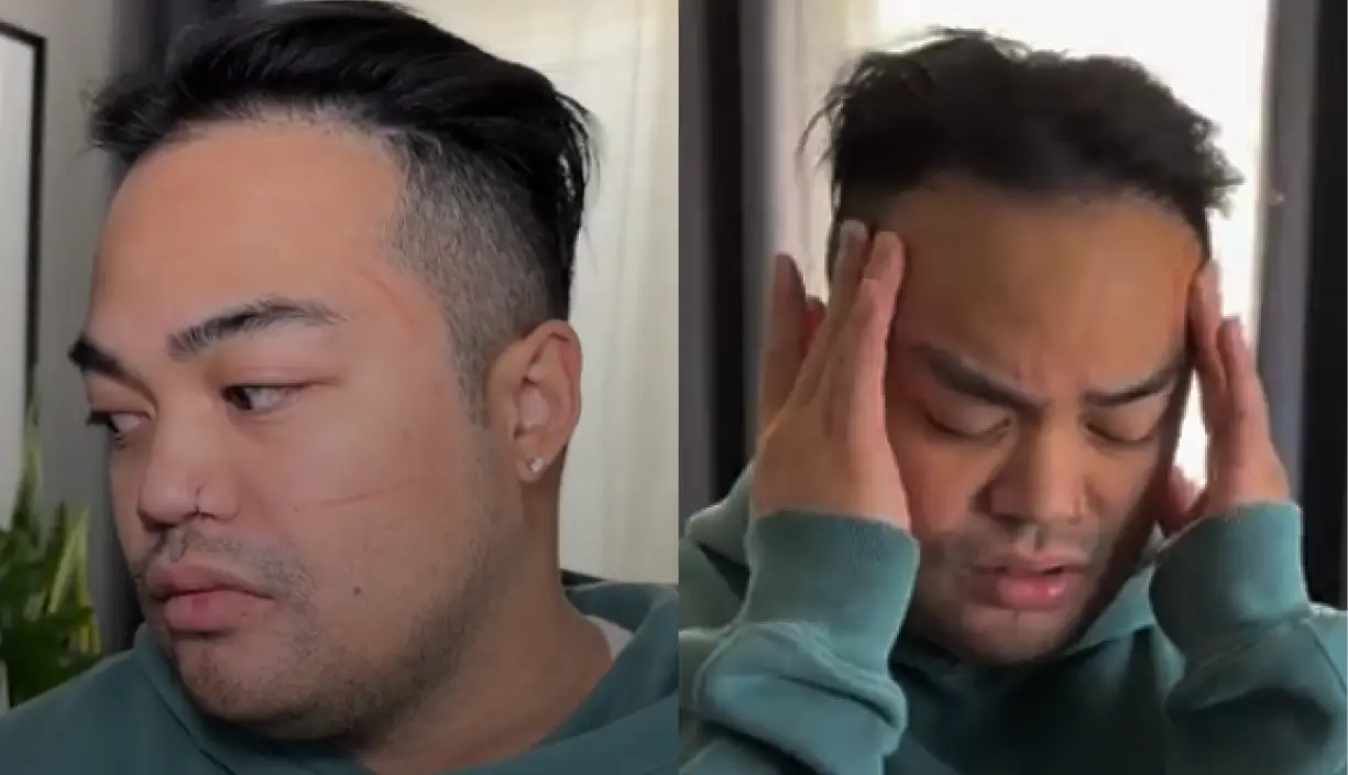 Quest 3 facial pressure and discomfort